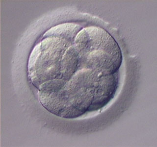 asisted Hatching in tamilnadu
