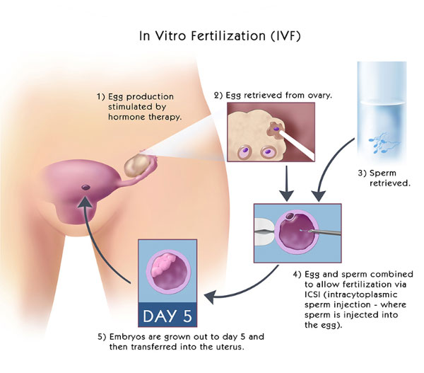 best ivf center in tamilnadu