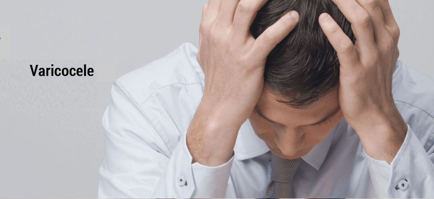Varicocele Treatment best varicocele treatment in india