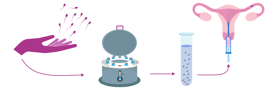 Sperm Donor Program donar program in tamilnadu