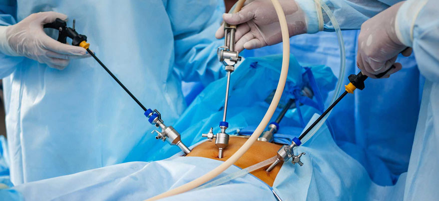 Laparpscopy Specialist laparpscopy specialist in tamilnadu