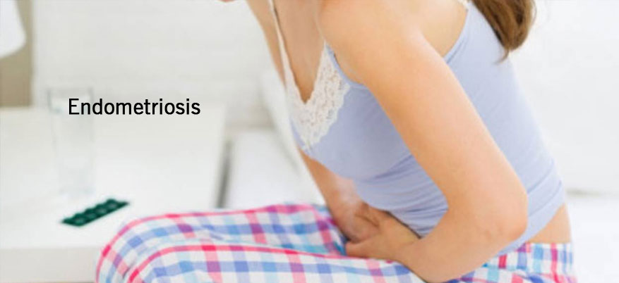 Endometriosis surgery in Tamilnadu Endometriosis surgery in Tamilnadu