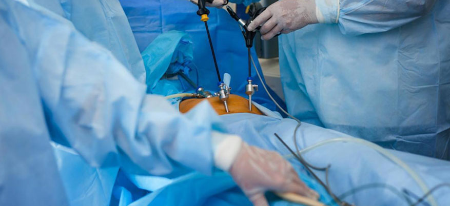 gynae laparoscopic Surgeon in india gynae laparoscopic Surgeon in india