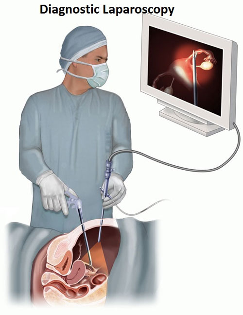 Laparoscopic Hospital laparoscopic surgeonn in coimbatore