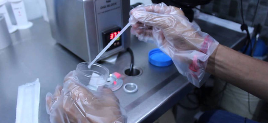 Male Fertility Test Male fertility test in coimbatore