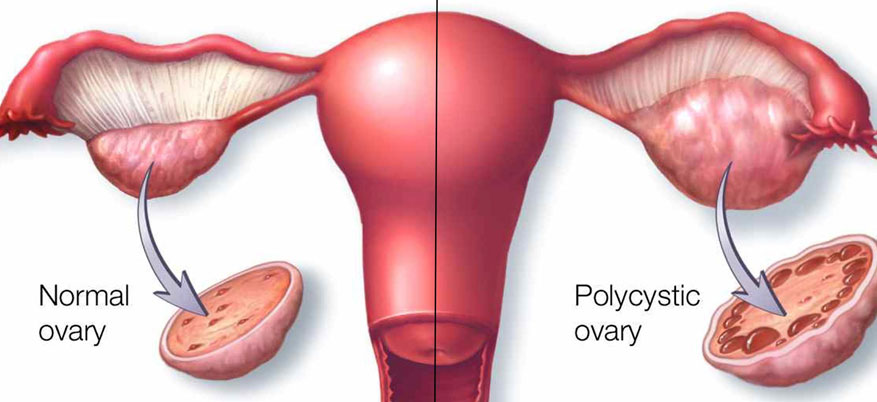 Best Maternity Hospital in Coimbatore best maternity hospital in Coimbatore