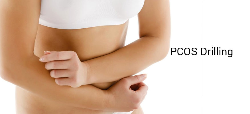 PCOS Diagnosis pcos diagnosis