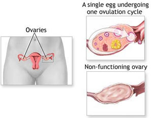 POF Treatment in India pof treatment in india