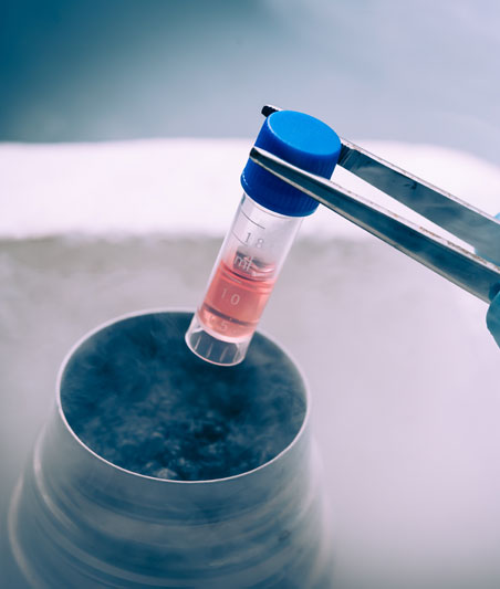 Sperm Donation Center sperm donation center in coimbatore