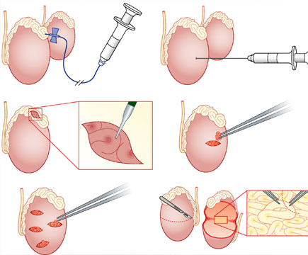 Laparoscopic Surgery laparoscopic surgery cost in coimbatore
