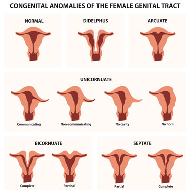Uterine Abnormalities Treatment Uterine abnormalities treatment