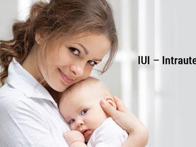 IUI (Intra uterine insemination) husband